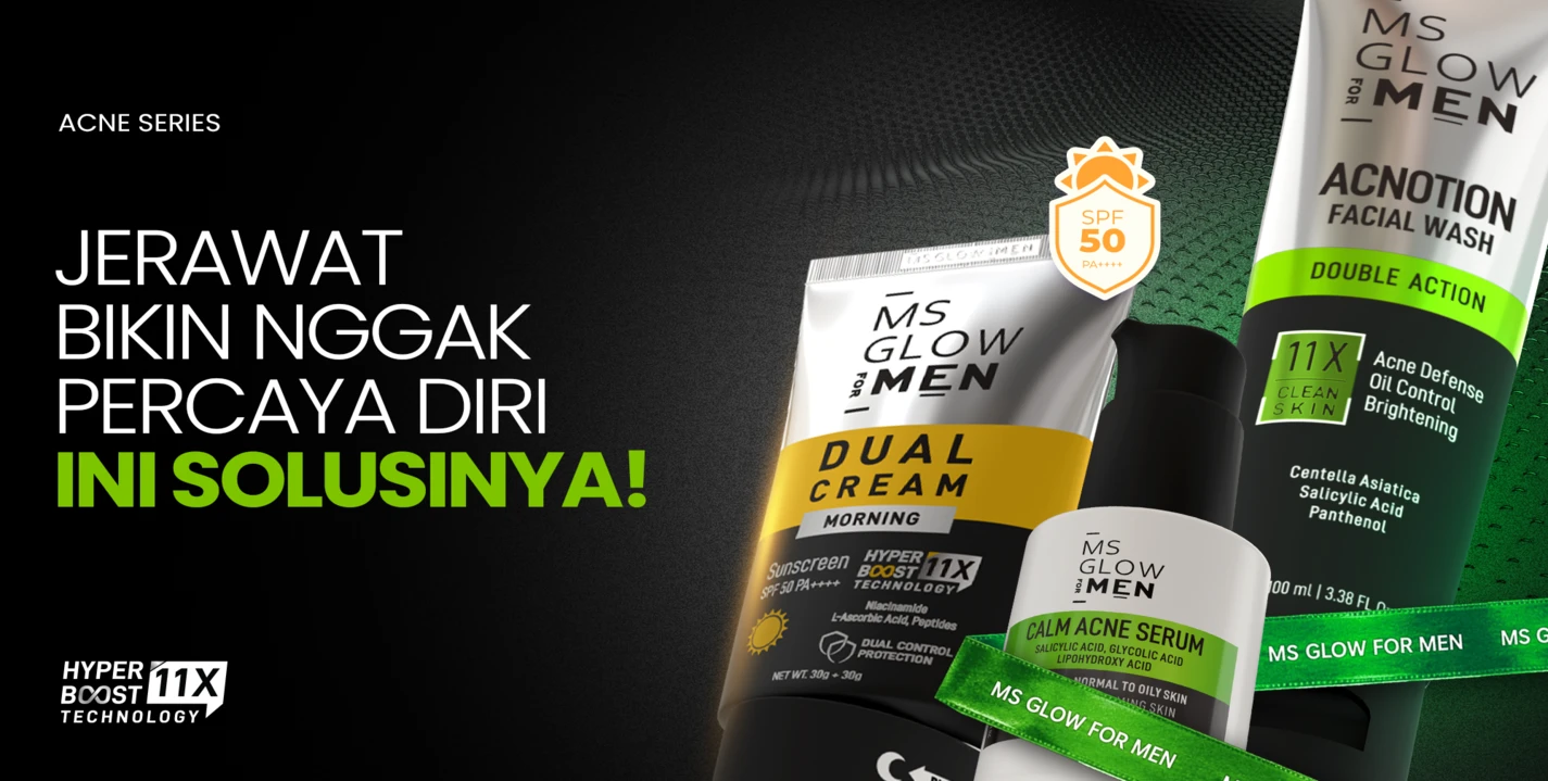 MSGLOW FORMEN Banner 10